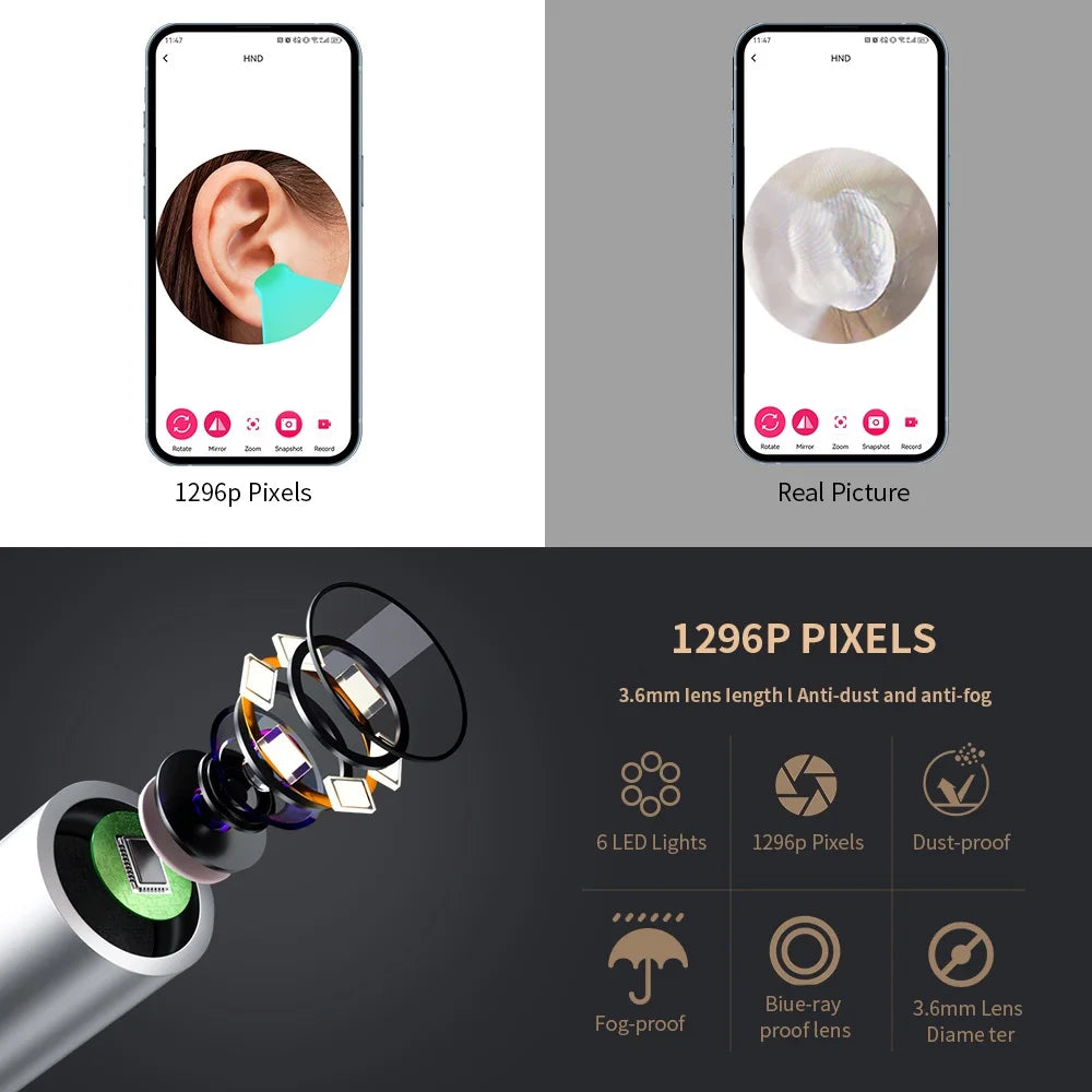 Wireless Smart Visual Ear Cleaner with Camera